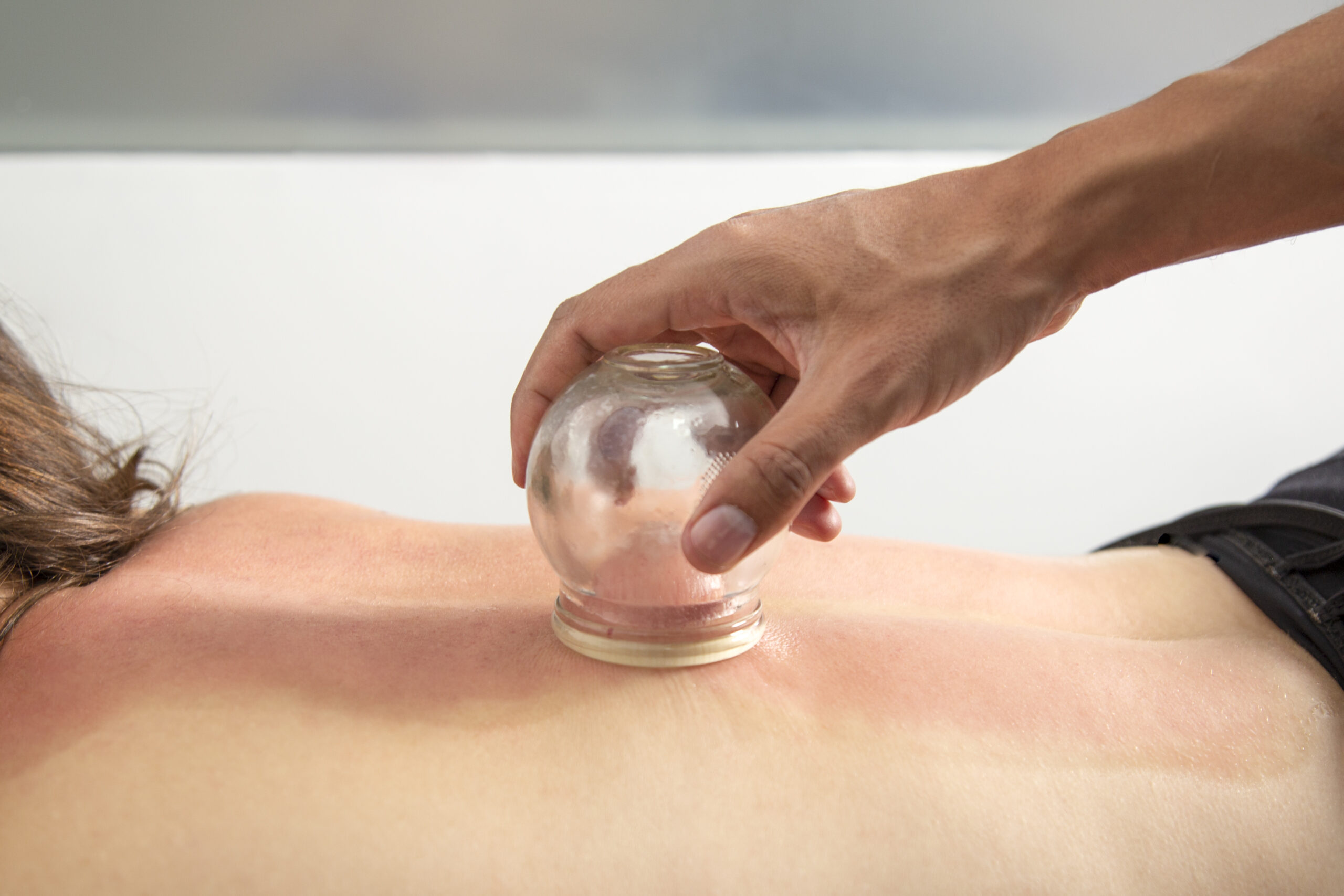 Manual moving cupping therapy treatment at Elite Physical Therapy and Performance